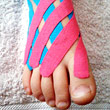 Kinesiotaping