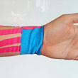 Kinesiotaping